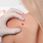 Акция на услуги дерматолога