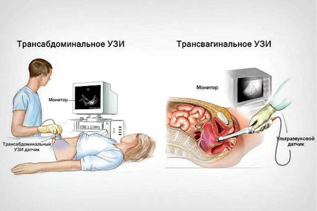 Гинеколог в Белгороде — запись на прием к платному гинеколог в Клинике Фомина