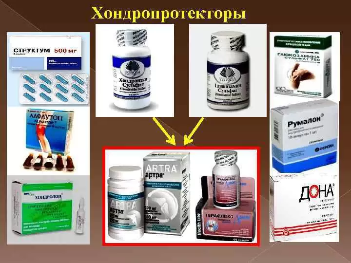 Недорогие и эффективные мази от боли в спине: 14 лучших вариантов ...