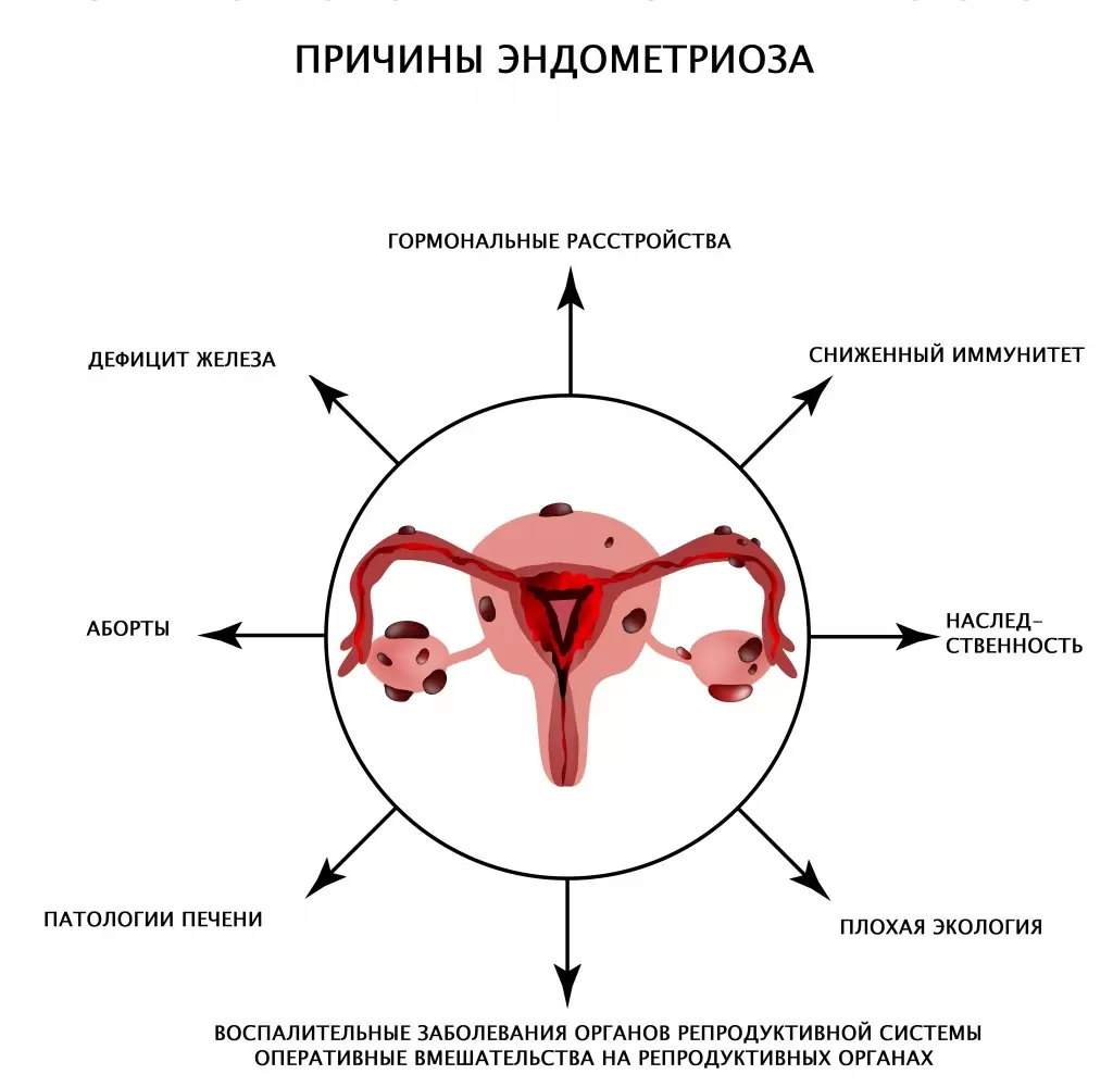 влагалище наружу 