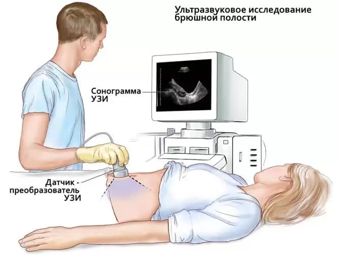 Бульбит дуоденит — цены и лечение в Москве «Медлайн-Сервис»