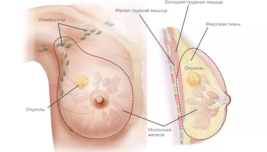 Стоят соски